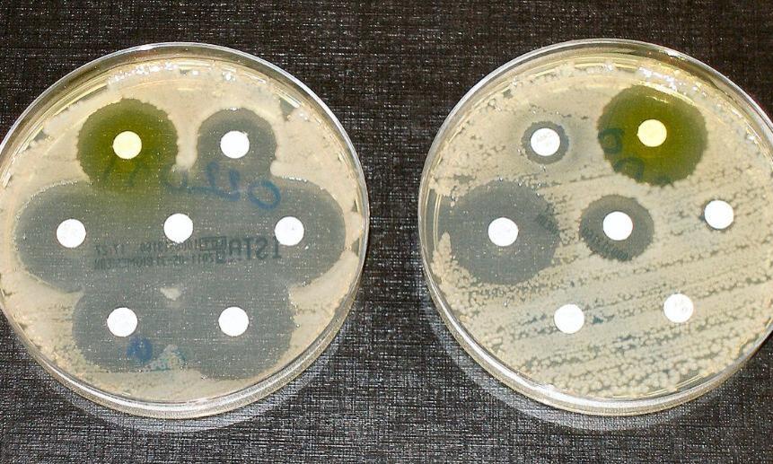 Тестирование бактерий на устойчивость к антибиотикам. Фото: Dr Graham Beards (CC BY-SA 4.0).